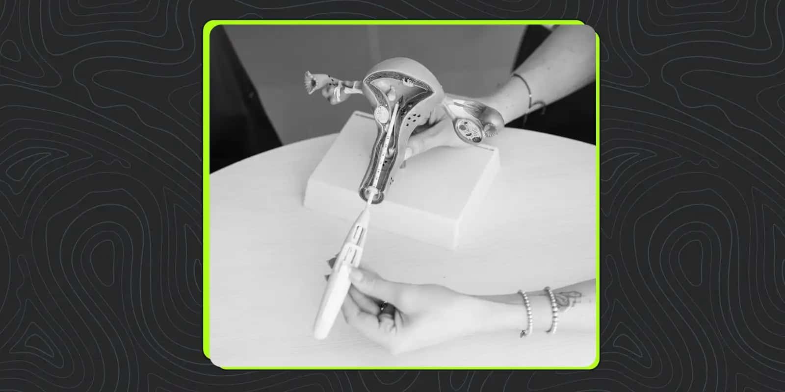 The Critical Question: Which Contraceptive Method Prevents STDs?